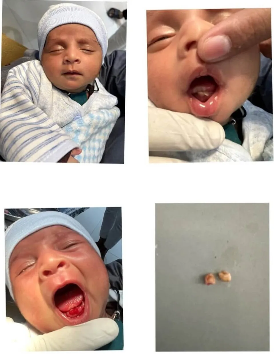 Paediatric dental technology and child-friendly environment at MY DENTIST Kakadeo