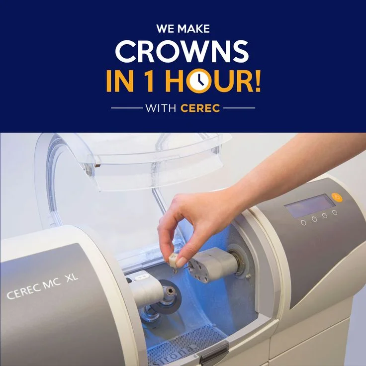 Crowns in 1 Hour (CEREC Dentistry)