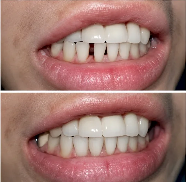 Digital dental technology for prosthodontics at MY DENTIST Kakadeo