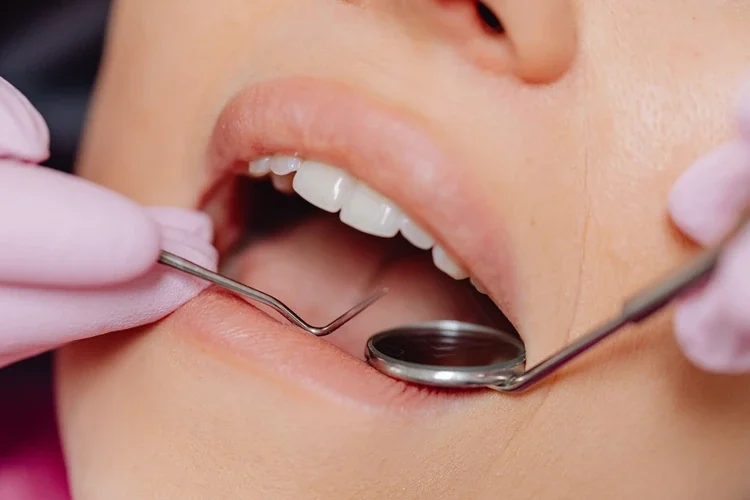 Restorative dentistry at MY DENTIST Kanpur