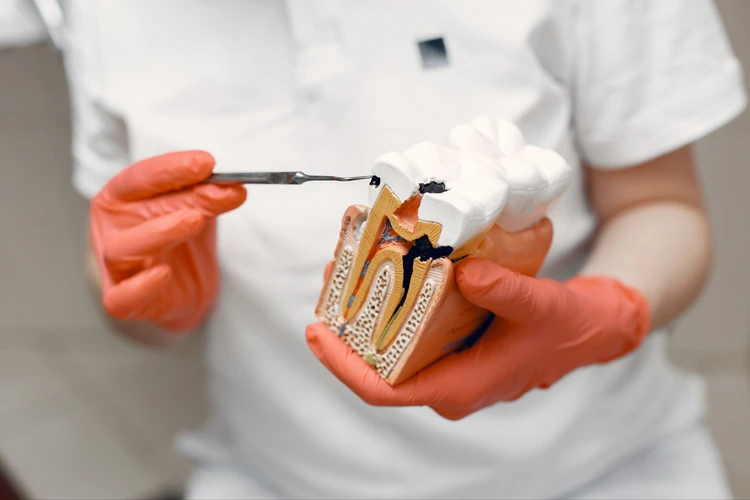 MDS Endodontist Dr. Asheesh K. Sawhny performing painless root canal treatment using rotary endodontics at Dr Sawhney’s My Dentist, Kakadeo, Kanpur